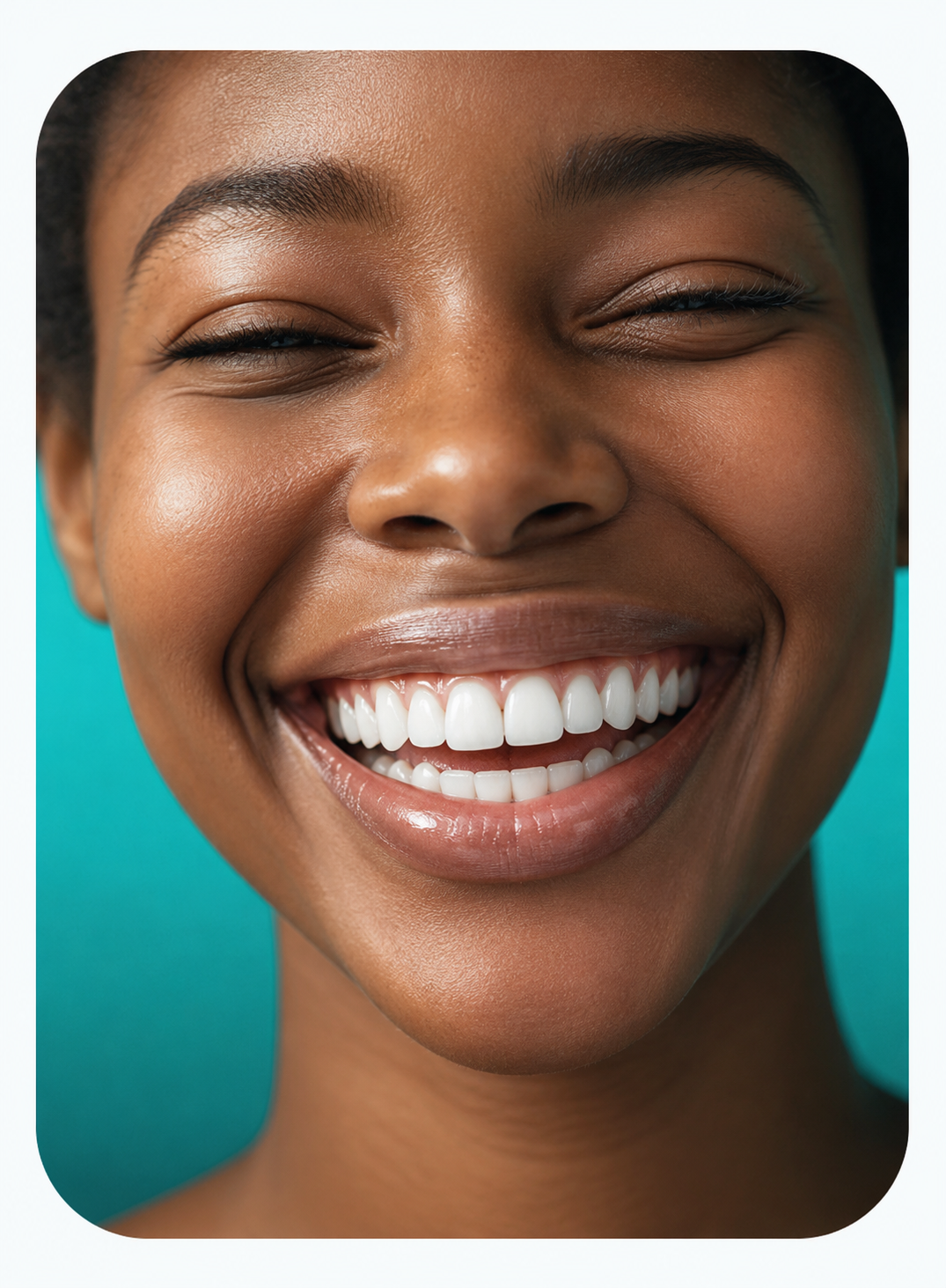 Whitening trays
